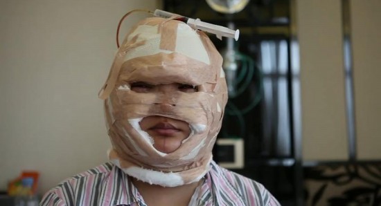 王梓整容前后對比 微博直播整容過程