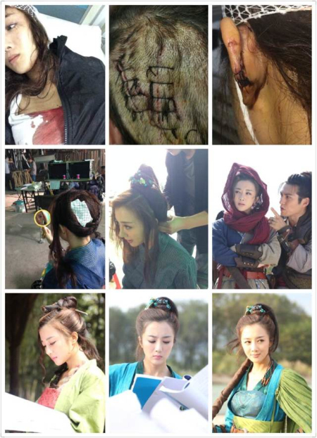 葉璇寵物狗咬人 李依曉頭部被咬傷