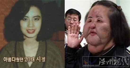 韓國電風扇大媽整容失敗