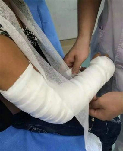 學生被老師推骨折