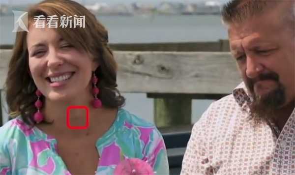 看電視發(fā)現(xiàn)患腫瘤